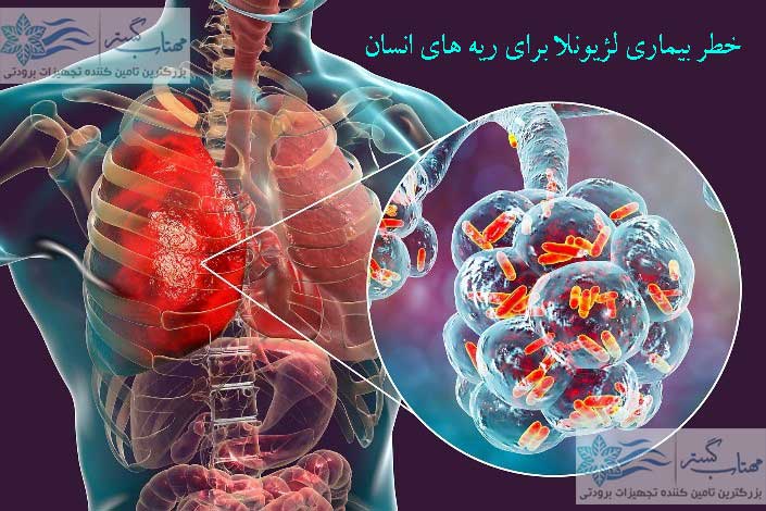 خطر-بیماری-لژیونلا-برای-ریه-های-انسان